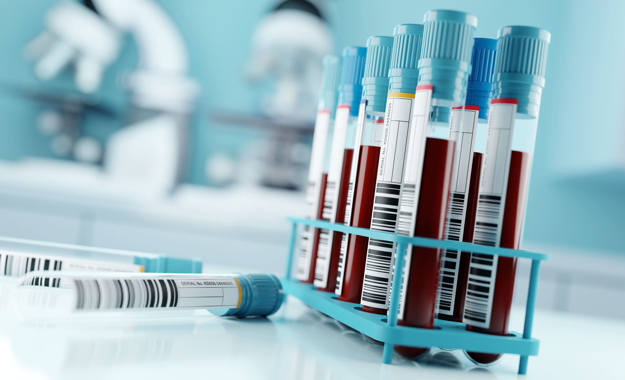 Image Kaizen HbA1c test
