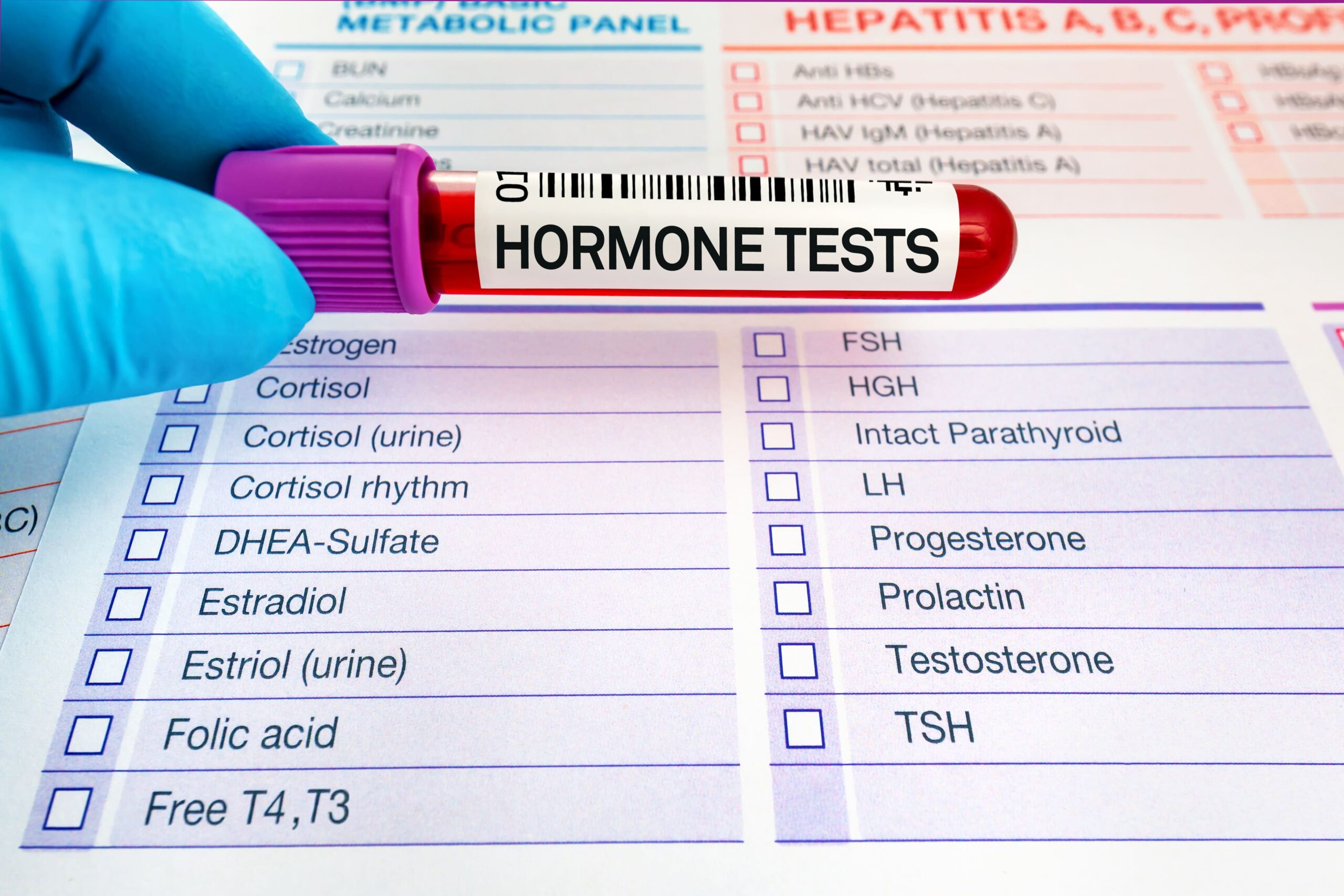 Image Kaizen hormone test