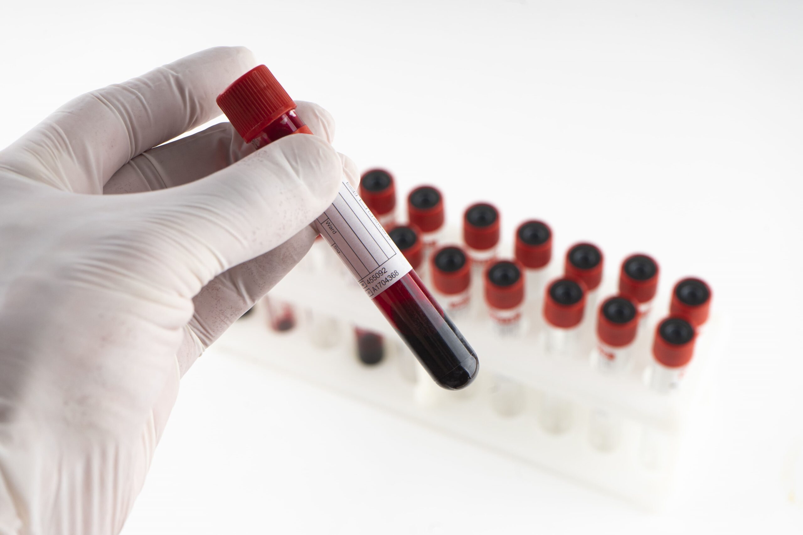Image Kaizen liver function test