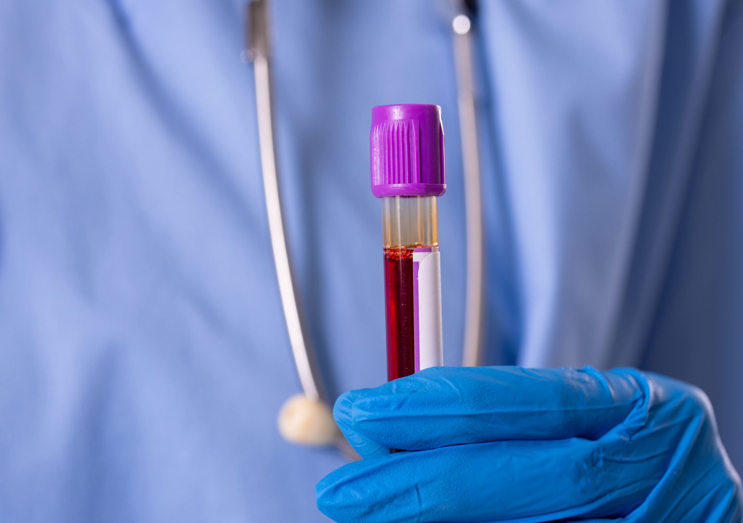 Image diabetes test