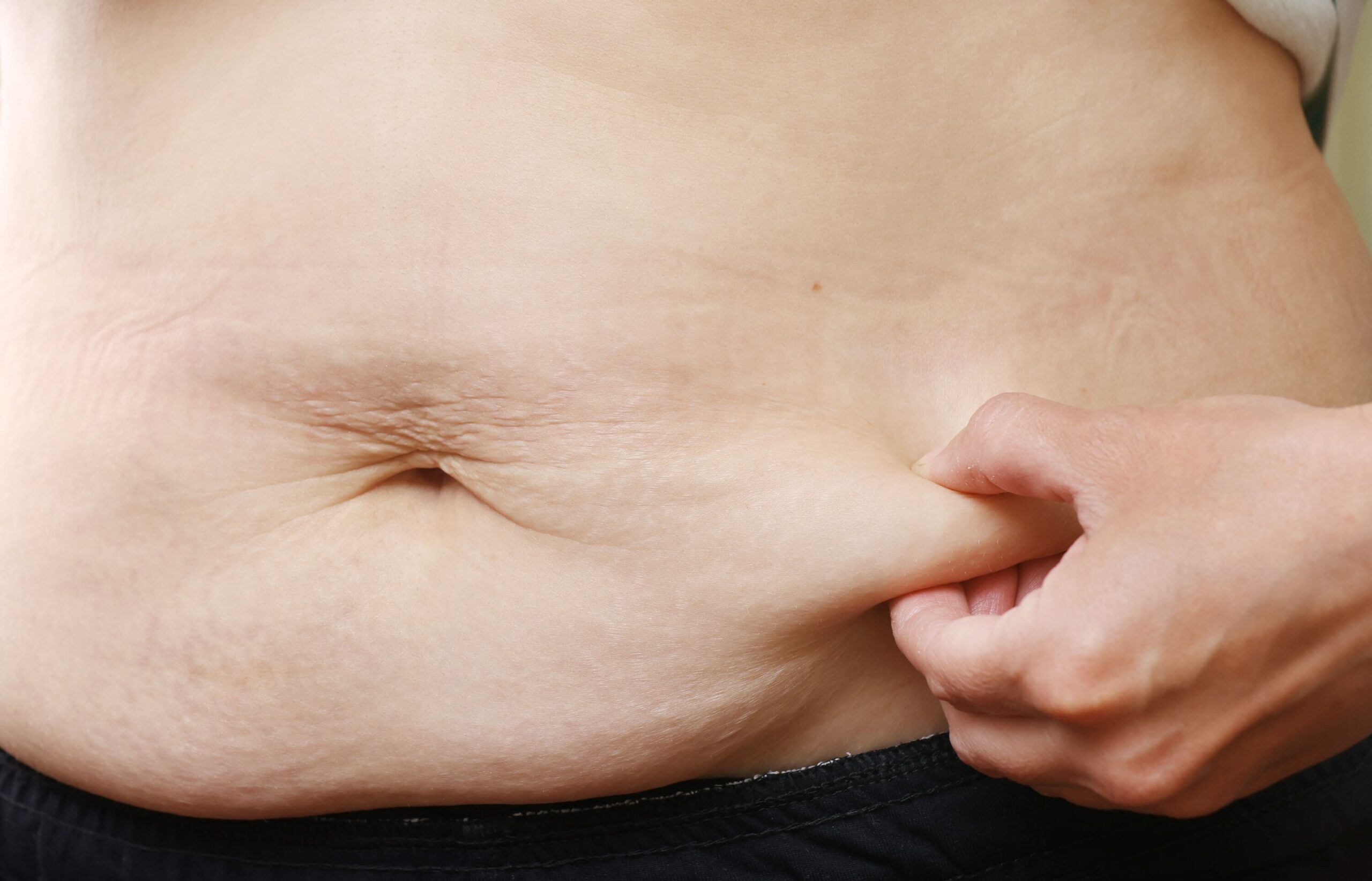 Image Why Belly Fat Is More Than Just Aesthetic